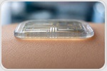 Wearable Microneedle Sensor Enables In Vivo Bioanalysis of Cardiac Biomarkers