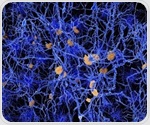 Brain changes detect Alzheimer's seven years before plaques appear