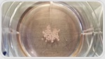 Brain organoid studies on the ISS move closer to new treatments