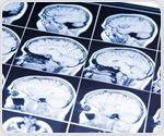 Short workouts or naps protect memory after sleep deprivation
