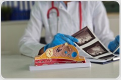 New potential target for triple-negative breast cancer