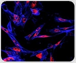 Targeting cyclin-dependent kinases offers new pathways for cancer therapy