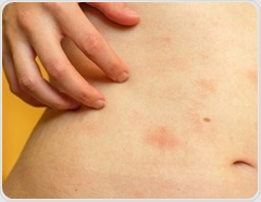 Paying attention to your body may change how an acute skin inflammation unfolds