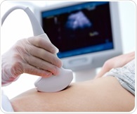 Wearable ultrasound patch tracks critical central venous pressure