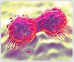 Study shows how prostate tumors rewire metabolism to resist therapy