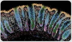 Researchers identify early molecular warning signs of inflammatory bowel disease