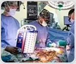 Molecular mapping reveals hidden cellular programs in heart transplant rejection