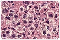 Cellares to expand automated manufacturing to gene-edited stem cell therapies