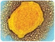 Weakened form of Mpox drove the 2022 global outbreak