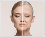 AI-designed drug candidate reverses biological age in clinical study