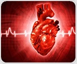 OCT imaging proves noninferior to intravascular ultrasound for complex heart stenting