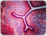 Deep-learning tissue clocks reveal how organs age and leave disease-linked signals in blood