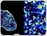 Super-Resolution DNA Imaging Platform Links Chromatin Loosening to Tumor Progression
