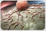 Study shows how the microbiome shapes lung cancer immunotherapy outcomes
