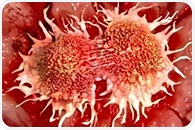 Protein-based MRI agent detects tiny lung cancer metastases
