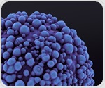 MIT biologists discover cellular pathway that triggers colon cancer spread