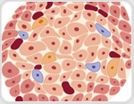 Immune-shielded iPSC islet cells for diabetes