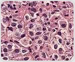 PIWI proteins and piRNAs may unlock more effective stem cell therapies