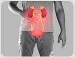 A New Approach to Preventing Bladder Cancer Recurrence