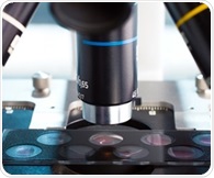 Yokogawa brings publication-backed validation from more than 60,000 scientific publications to its CSU spinning disk confocal systems with Bioz