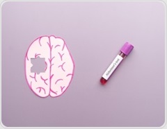 A study links a blood protein to memory and brain changes in Down syndrome