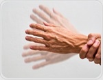 Year-long trial finds NAD-boosting supplement fails to improve early Parkinson's symptoms