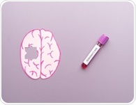A study links a blood protein to memory and brain changes in Down syndrome