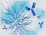 Nearly one in three women with autoimmune diseases waited at least four years for a diagnosis, survey finds