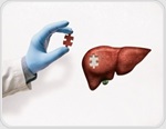 Could mRNA vaccine technology help repair damaged livers?