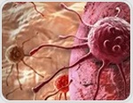 CRISPR activation library uncovers gene driving lymphoma growth and resistance