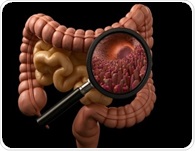 Semaglutide and teduglutide reduce immune-driven gut injury in mice