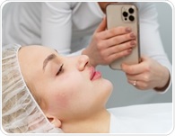 A simple facial photograph may hold clues to cancer survival