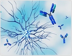 Nearly one in three women with autoimmune diseases waited at least four years for a diagnosis, survey finds