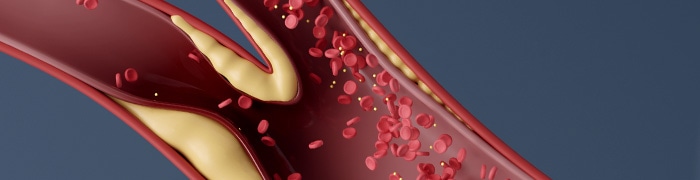 Cholesterol tile image