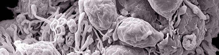 Electron Microscopy tile image