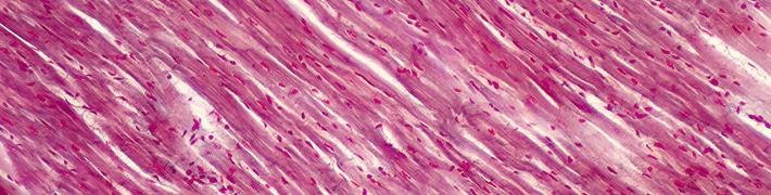 Muscular Dystrophy tile image