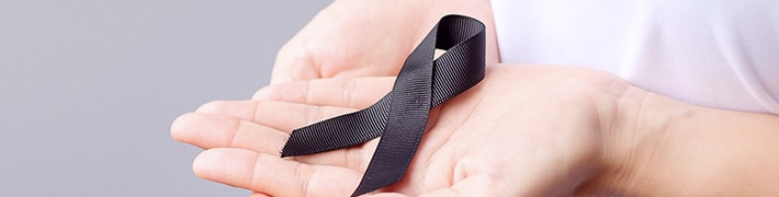 Skin Cancer tile image